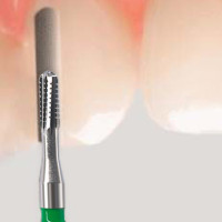 Snímanie koruniek (prepiľovanie, sťahováky) Snímanie koruniek (prepiľovanie, sťahováky)