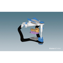 Ceramill Mind Artex SW (virtulny artikultor)