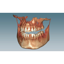 Ceramill Dicom Viewer