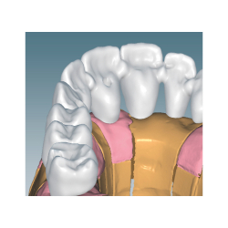 Ceramill M-Plant (abutment tool)