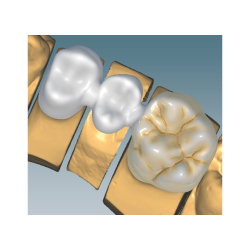InCadCam software (add-on Ceramill Mind)