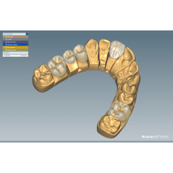 Ceramill Mindforms 2.0 by Knut Miller