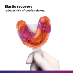 Elastick obnova tvaru  zniuje riziko nkladnho zhotovenia odtlaku nanovo