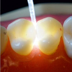 Microlux 2 pri pouit