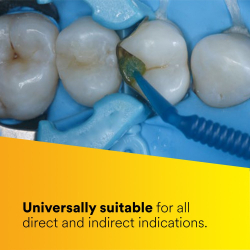 Univerzlne adhezvum vhodn pre vetky priame a nepriame indikcie